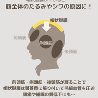 画像2229
